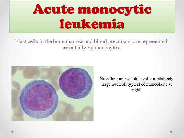 Acute monocytic leukemia blast cells in the bone marrow and blood precursors are represented