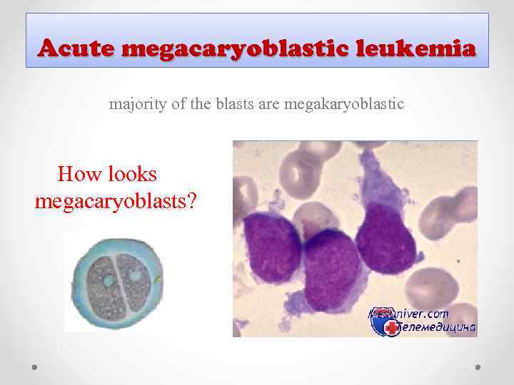 Acute megacaryoblastic leukemia majority of the blasts are megakaryoblastic How looks megacaryoblasts? 
