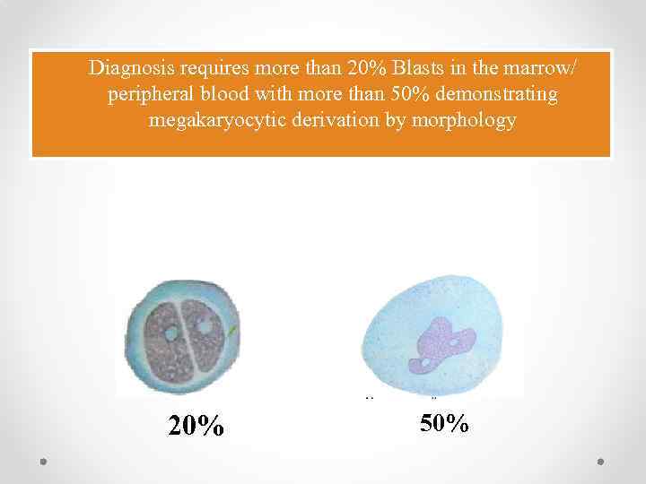 Diagnosis requires more than 20% Blasts in the marrow/ peripheral blood with more than