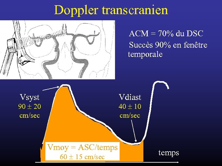Doppler transcranien ACM = 70% du DSC Succès 90% en fenêtre temporale Vsyst Vdiast