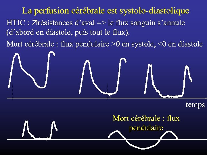 La perfusion cérébrale est systolo-diastolique HTIC : résistances d’aval => le flux sanguin s’annule