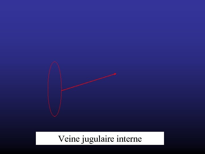 Veine jugulaire interne 