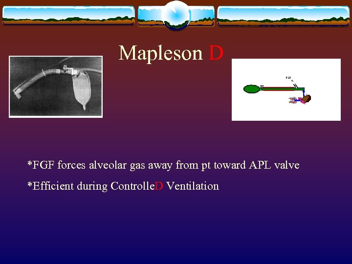Mapleson D *FGF forces alveolar gas away from pt toward APL valve *Efficient during