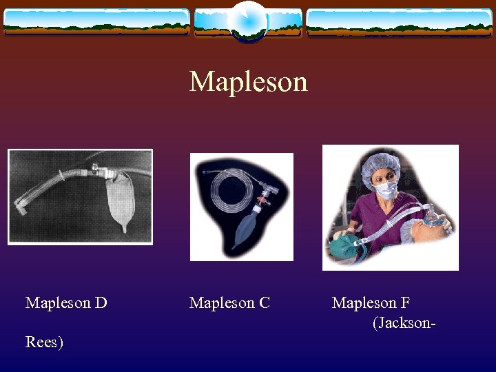 Mapleson D Mapleson C Mapleson F (Jackson. Rees) 