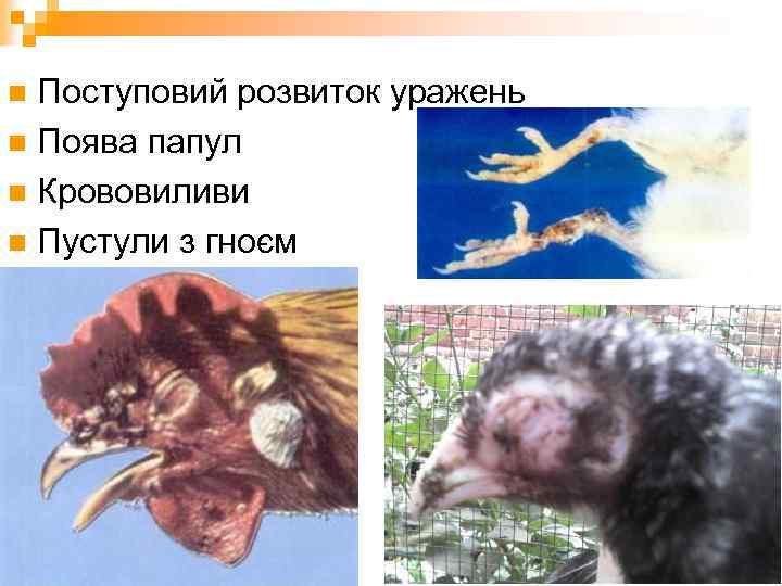 Поступовий розвиток уражень n Поява папул n Крововиливи n Пустули з гноєм n 