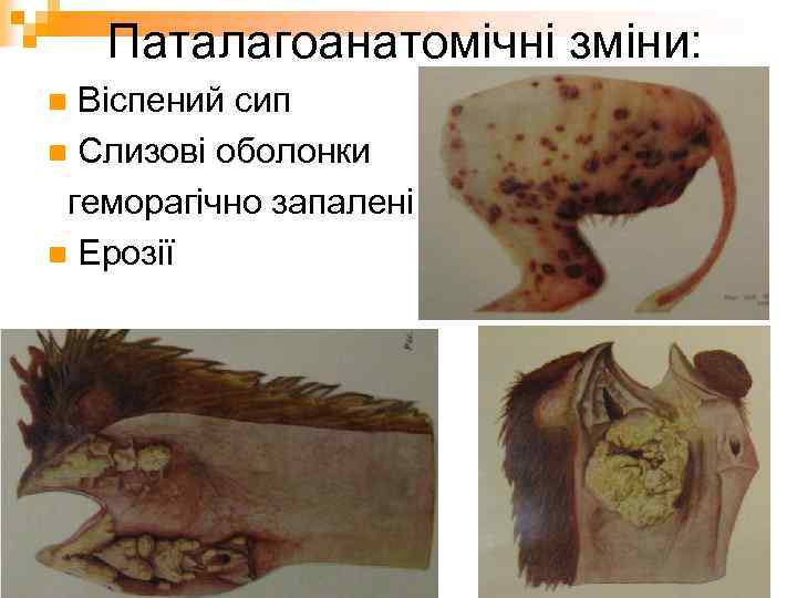 Паталагоанатомічні зміни: Віспений сип n Слизові оболонки геморагічно запалені n Ерозії n 