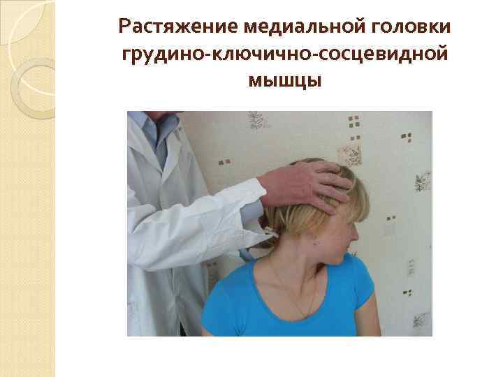 Растяжение медиальной головки грудино-ключично-сосцевидной мышцы 
