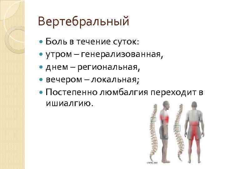 Вертебральный Боль в течение суток: утром – генерализованная, днем – региональная, вечером – локальная;