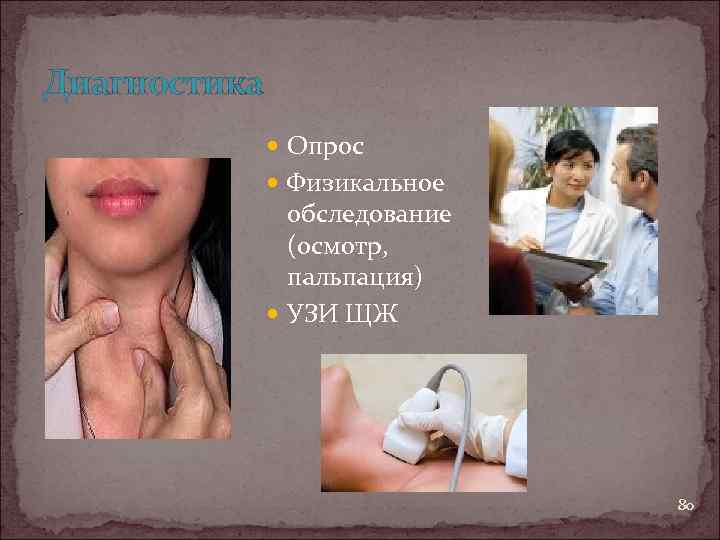 Диагностика Опрос Физикальное обследование (осмотр, пальпация) УЗИ ЩЖ 80 
