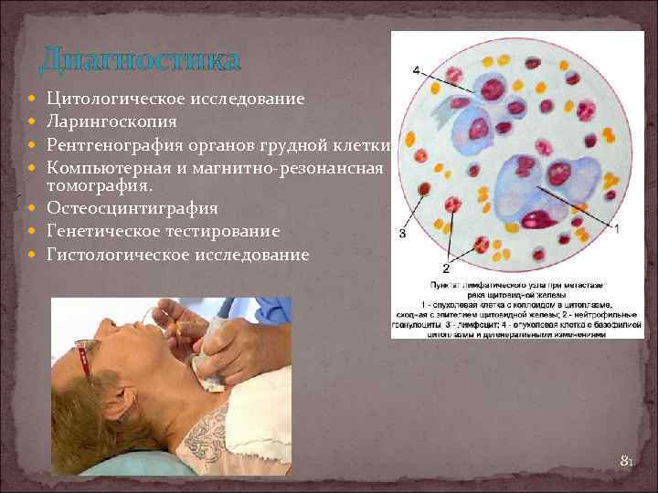 Диагностика Цитологическое исследование Ларингоскопия Рентгенография органов грудной клетки Компьютерная и магнитно-резонансная томография. Остеосцинтиграфия Генетическое