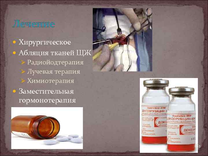 Лечение Хирургическое Абляция тканей ЩЖ Ø Радиойодтерапия Ø Лучевая терапия Ø Химиотерапия Заместительная гормонотерапия