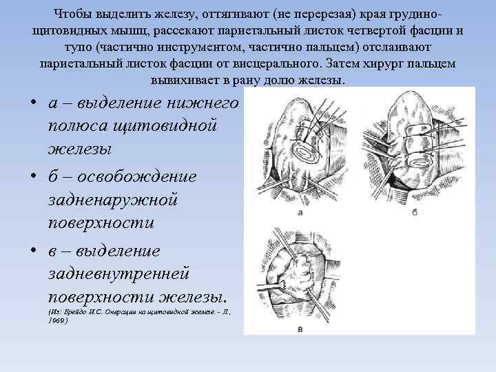 Чтобы выделить железу, оттягивают (не перерезая) края грудино щитовидных мышц, рассекают париетальный листок четвертой