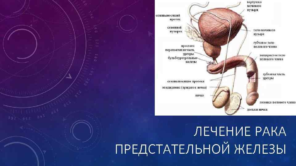 ЛЕЧЕНИЕ РАКА ПРЕДСТАТЕЛЬНОЙ ЖЕЛЕЗЫ 