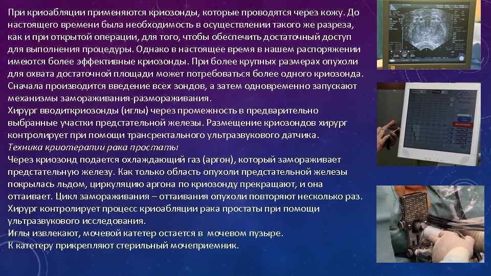 При криоабляции применяются криозонды, которые проводятся через кожу. До настоящего времени была необходимость в