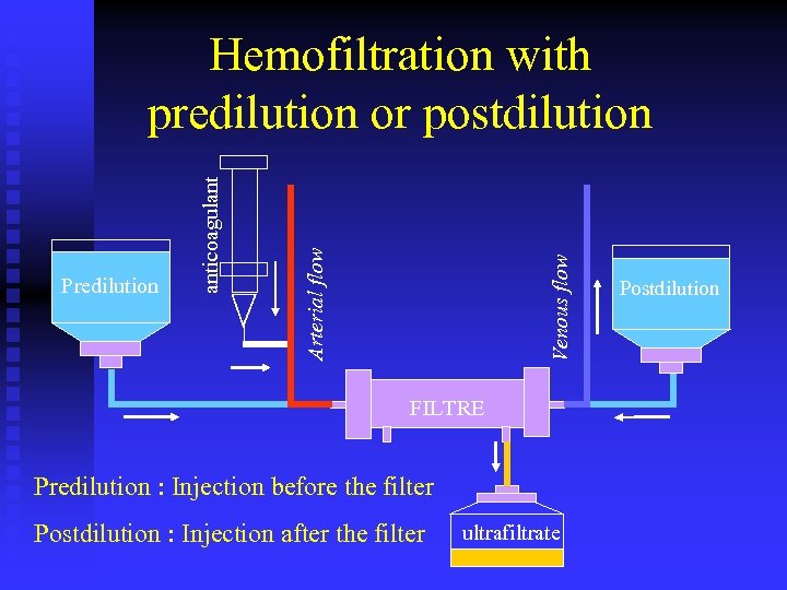 Venous flow Arterial flow Predilution anticoagulant Hemofiltration with predilution or postdilution FILTRE Predilution :