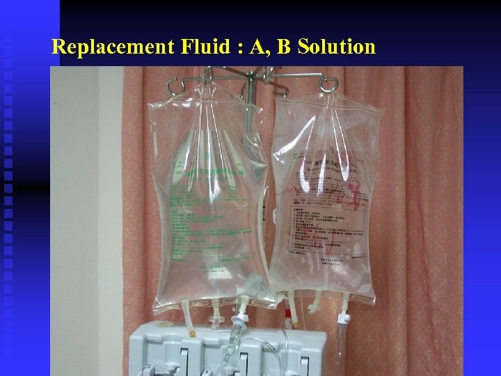 Replacement Fluid : A, B Solution 