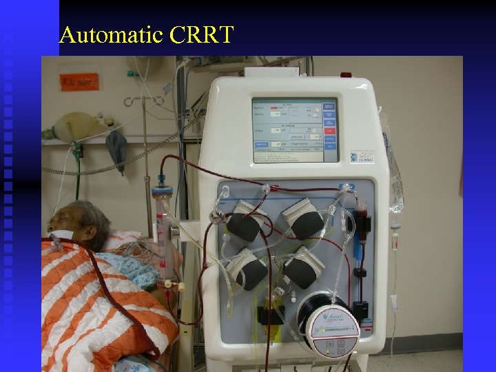 Automatic CRRT 