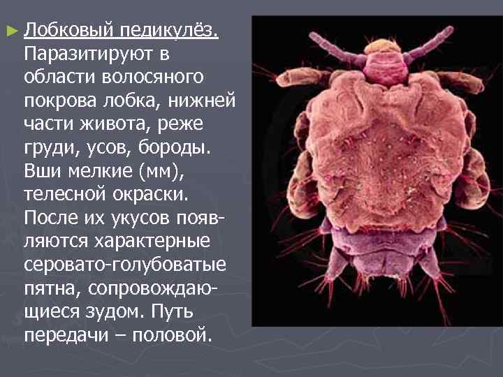 ► Лобковый педикулёз. Паразитируют в области волосяного покрова лобка, нижней части живота, реже груди,