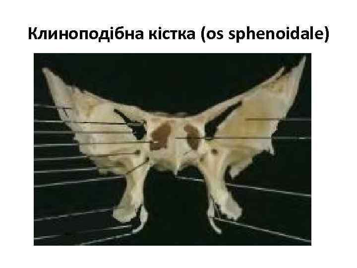Клиноподібна кістка (os sphenoidale) 