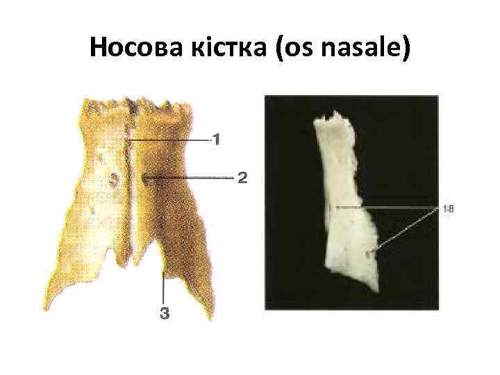 Носова кістка (os nasale) 