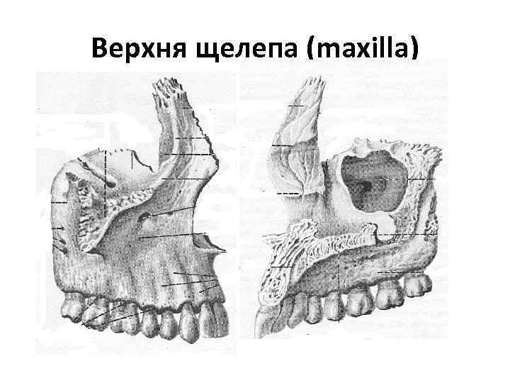 Верхня щелепа (maxilla) 
