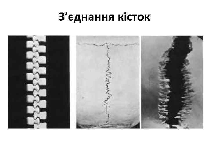 З’єднання кісток 