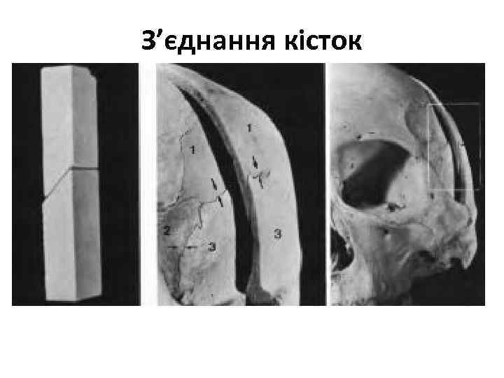 З’єднання кісток 