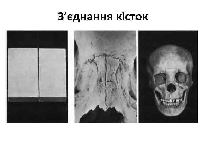 З’єднання кісток 