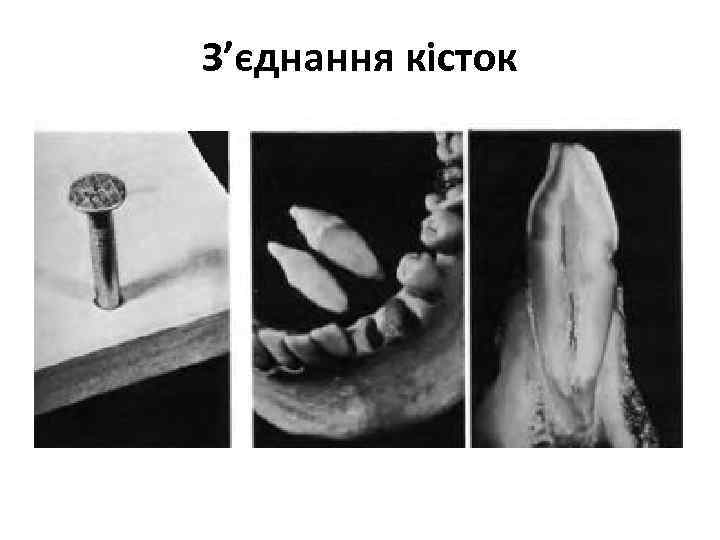 З’єднання кісток 