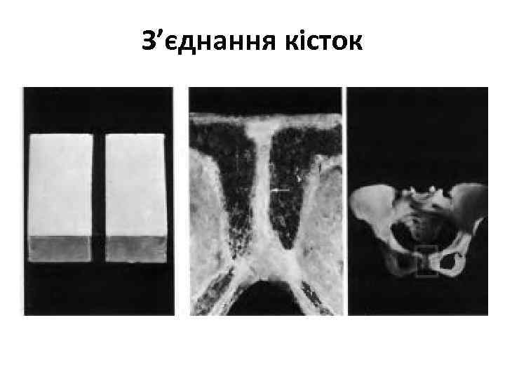 З’єднання кісток 
