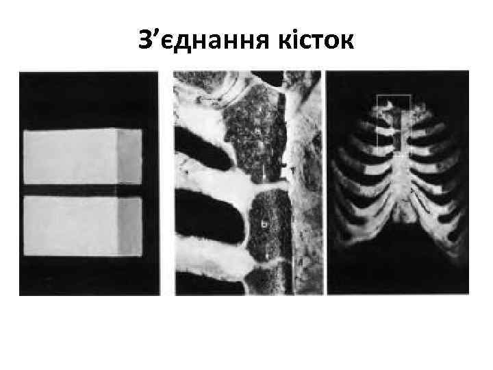 З’єднання кісток 