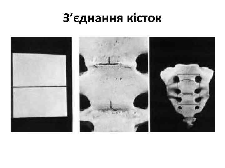 З’єднання кісток 