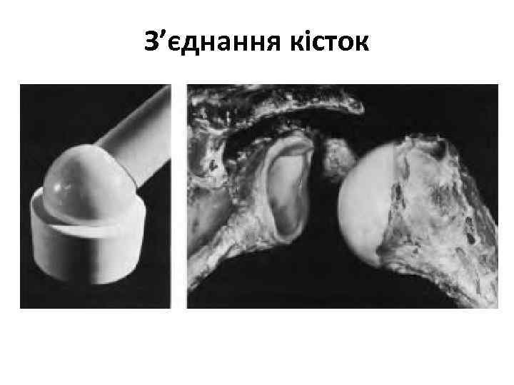 З’єднання кісток 