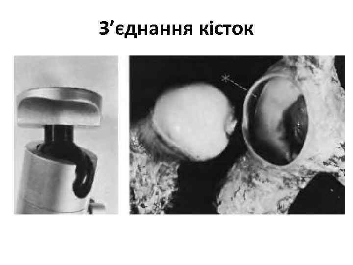 З’єднання кісток 