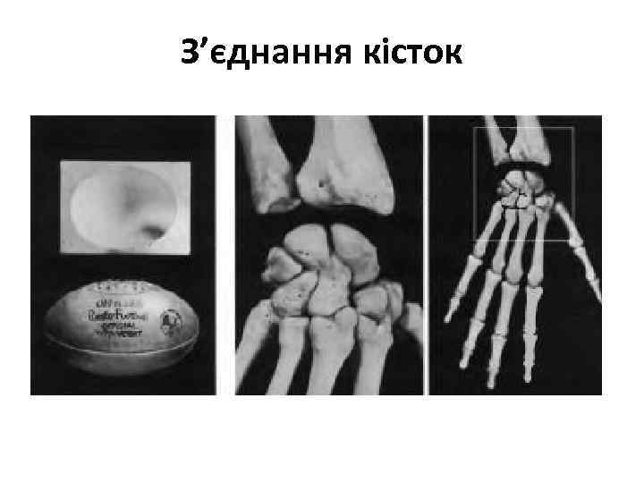 З’єднання кісток 