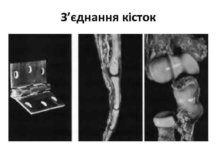 З’єднання кісток 