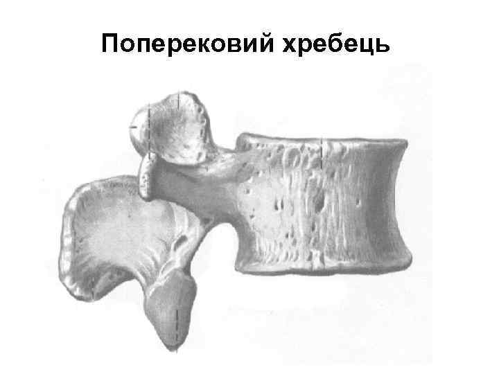 Поперековий хребець 