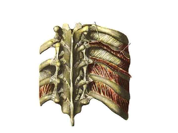 Артроз реберно позвоночных сочленений. Реберно-поперечные суставы позвоночника. Реберно Позвоночный сустав артроз. Реберно поперечный реберно позвонковый артроз. Реберно Позвоночный артроз грудного отдела.