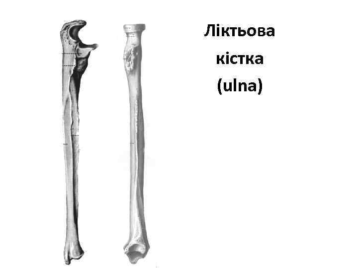 Ліктьова кістка (ulna) 