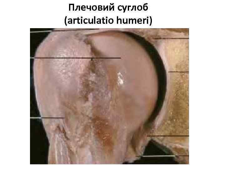 Плечовий суглоб (articulatio humeri) 