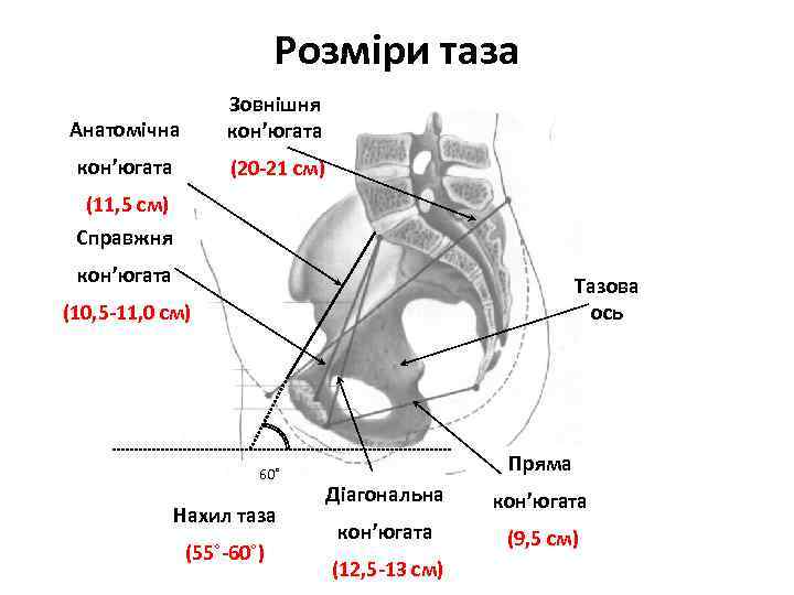 Розміри таза Анатомічна Зовнішня кон’югата (20 -21 см) (11, 5 см) Справжня кон’югата Тазова