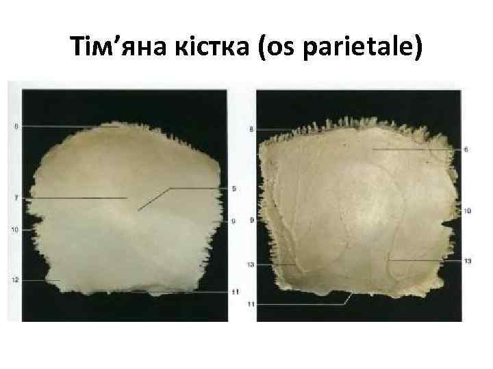 Тім’яна кістка (os parietale) 