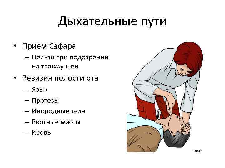 Дыхательные пути • Прием Сафара – Нельзя при подозрении на травму шеи • Ревизия
