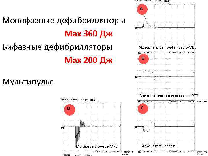 A Монофазные дефибрилляторы Max 360 Дж Бифазные дефибрилляторы Max 200 Дж Monophasic damped sinusoid-MDS