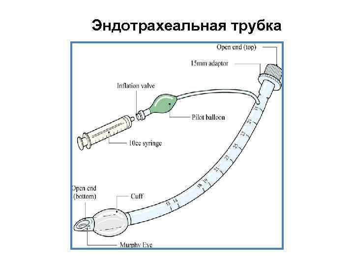 Эндотрахеальная трубка 