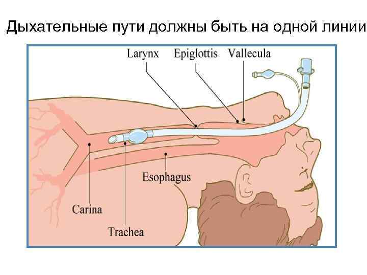 Дыхательные пути должны быть на одной линии 