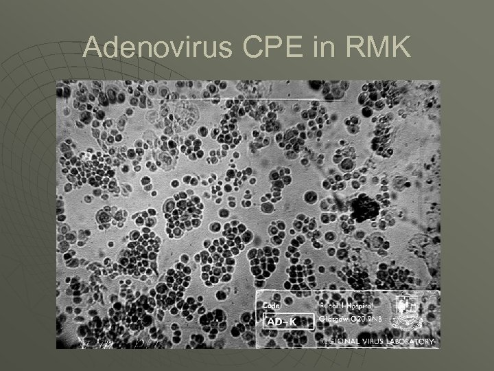 Molecular Diagnosis Of Respiratory Viruses And Its Impact