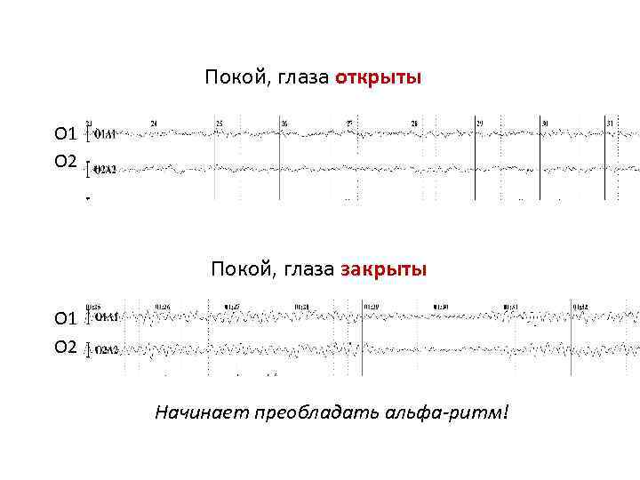 Покой, глаза открыты О 1 О 2 Покой, глаза закрыты О 1 О 2