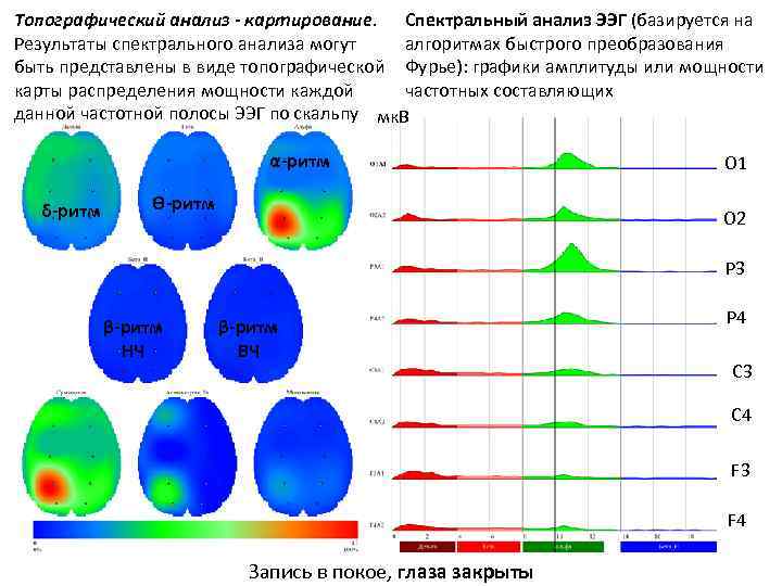 Топографический анализ - картирование. Cпектральный анализ ЭЭГ (базируется на Результаты спектрального анализа могут алгоритмах