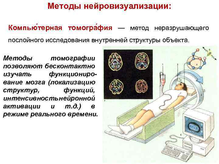 Исследуйте внутренние. Методы нейровизуализации мрт кт. Методы нейровизуализации.